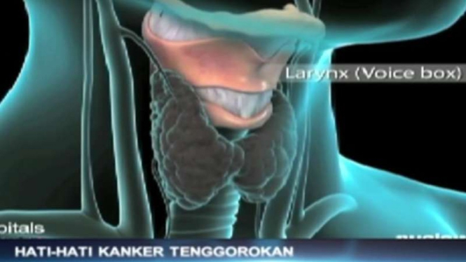 Tenggorokan