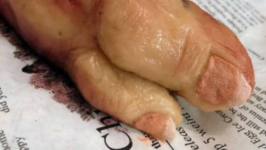 Kue berbentuk potongan tubuh manusia