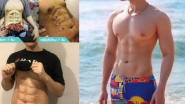 Operasi six pack di Thailand