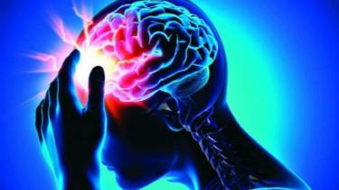 Ilustrasi stroke.