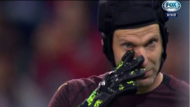 Kiper Arsenal, Petr Cech, menangis
