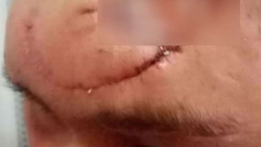 Pria selamat dari serangan beruang setelah menggigit lidah hewan itu