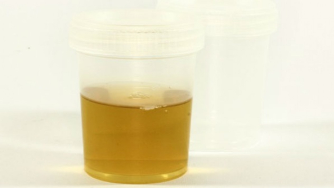 Urine.