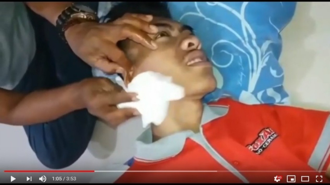 Pengobatan alternatif kanker Abah Kardali