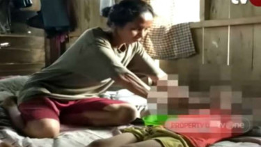 Seorang anak berusia lima tahun diterkam anjing liar saat bermain di halaman rumahnya di Bone, Sulawesi Selatan.