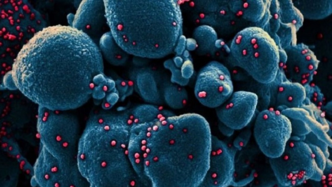 Penampakan virus corona | Foto credit [NIAID Flickr]