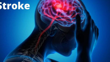 ilustrasi stroke