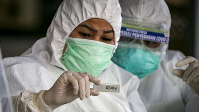 Petugas medis melakukan pemeriksaan cepat (rapid test) COVID-19. (Foto ilustrasi)