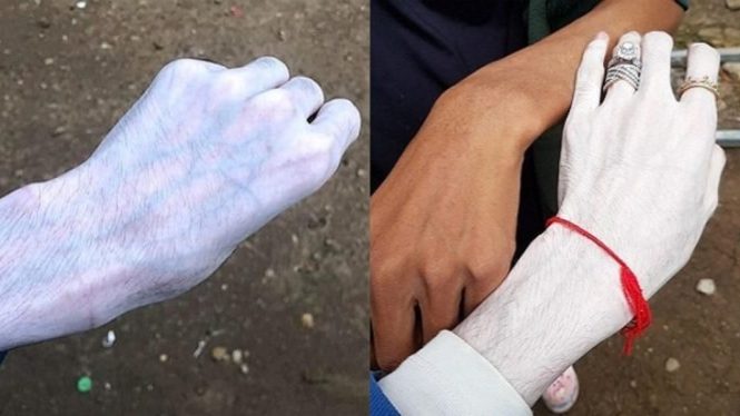 Krim pemutih Thailand yang viral.