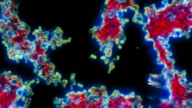 Wabah pes pernah menjadi penyakit yang paling ditakuti, namun kini penyakit tersebut bisa diobati dengan mudah.-Science Photo Library