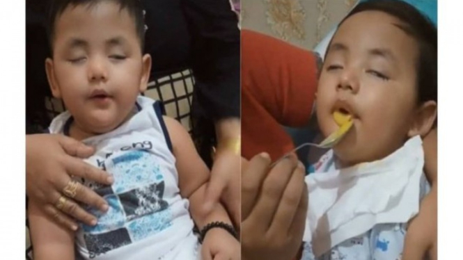 Shaka, bocah penderita sindrom putri tidur.