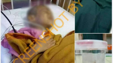 Tangkapan layar (screenshot) foto yang memperlihatkan seorang anak sedang dirawat dan diklaim mengalami pengecilan otak gara-gara radiasi sinar ponsel.