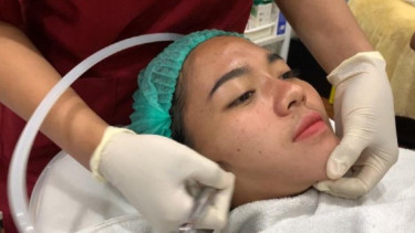 Facial