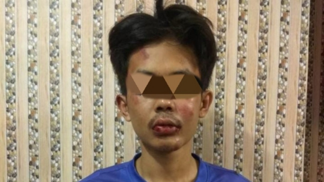 Pelaku penusuk Syekh Ali Jaber