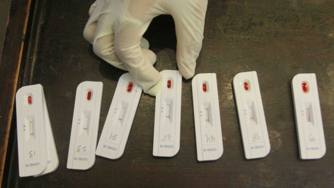 Ilustrasi hasil rapid test