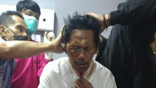 Imam Masjid di Garut dianiaya orang tak dikenal. 