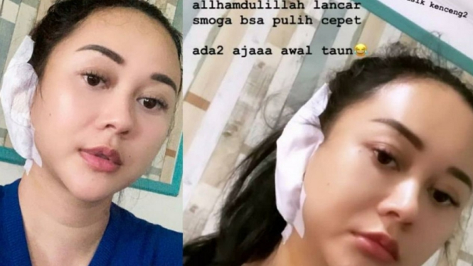 Kondisi Aura Kasih usai jalani operasi telinga