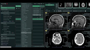  Alat CT Scan (Computed Tomography scan) dengan PACS