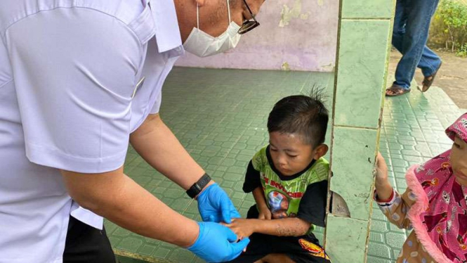 Anak-anak terserang wabah scabies 