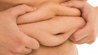 Lemak berlebih di perut indikasi obesitas.