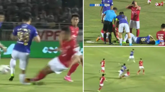 Kapten Timnas Vietnam, Do Hung Dung mengalami cedera kaki mengerikan saat berlag