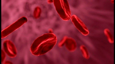 Ilustrasi gangguan Hemofilia