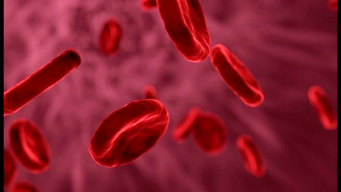Ilustrasi gangguan Hemofilia