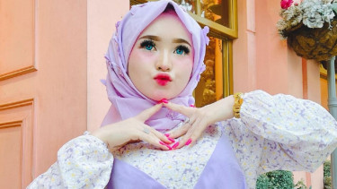 Selebgram Herlin Kenza.