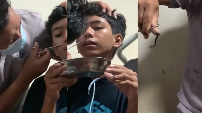 Viral di Hidung Bocah Ini Ada Binatang (Instagram/smart.gram)