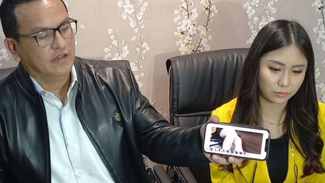 Ayu Thalia (kanan) tunjukkan bukti kaki memar diduga dianiaya Nicholas Sean.