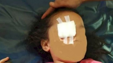 Sadis, Mata Anak Ini Dicongkel Ibunya (bukamatanews.id)