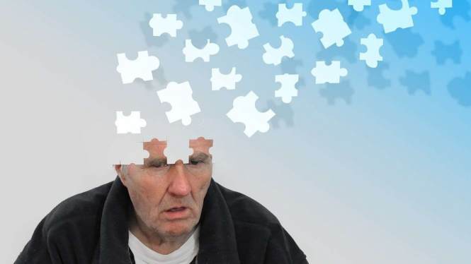 Ilustrasi Alzheimer.