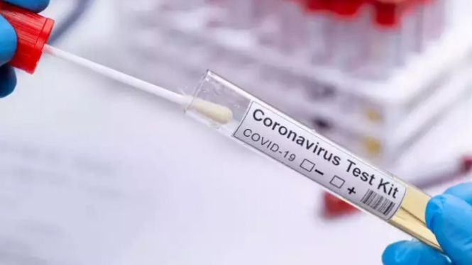 Virus corona