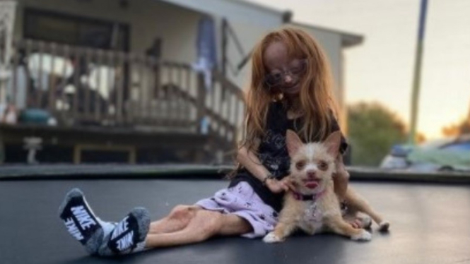 Adalia Rose