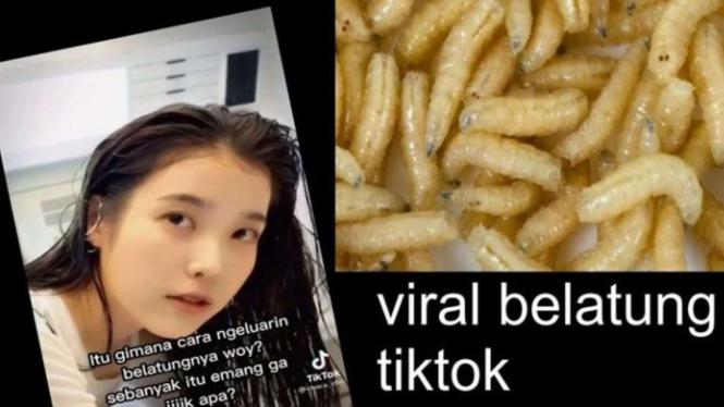 Video viral, belatung keluar dari vagina