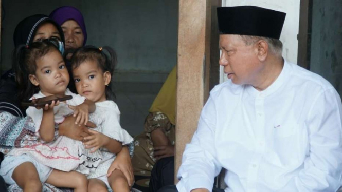 Bayi kembar siam di Lombok Timur.