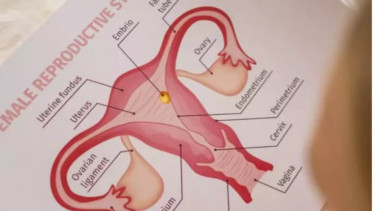 Ilustrasi vagina 