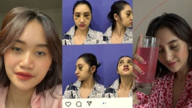 Permesta Dhyaz, putri Youtube Farida Nurhan