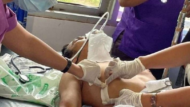 Glen Sumampow, korban penembakan kelompok kriminal bersenjata (KKB) di Ilaga, Kabupaten Puncak, Papua, Sabtu, 19 Februari 2022, masih dirawat di Puskesmas Ilaga.