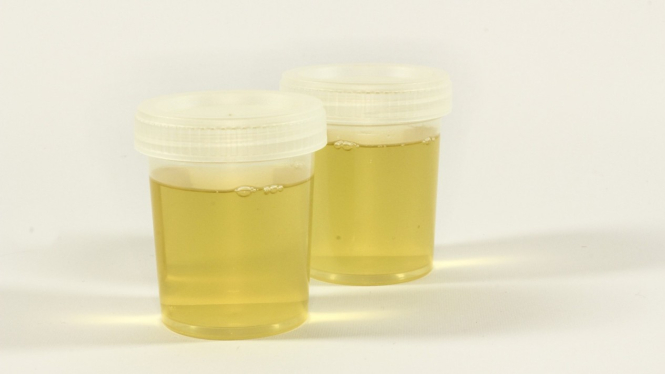 Ilustrasi urine.