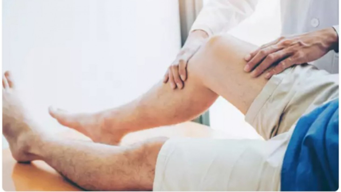 Rheumatoid Arthritis