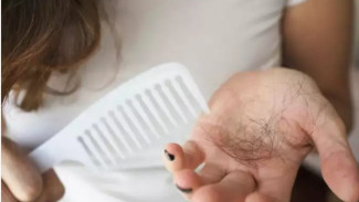 Penyebab Rambut Rontok di Usia Muda, Gaya Hidup Jadi Salah Satunya