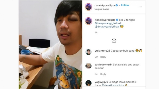 Kondisi Rian DMasiv pasca kecelakaan