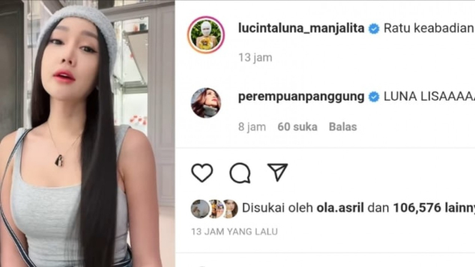 Penampilan Lucinta Luna usai operasi wajah di Korea