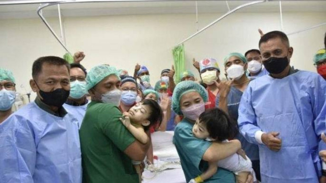 Operasi anak kembar siam berhasil dilakukan di (RSUP) Prof Kandou Manado.