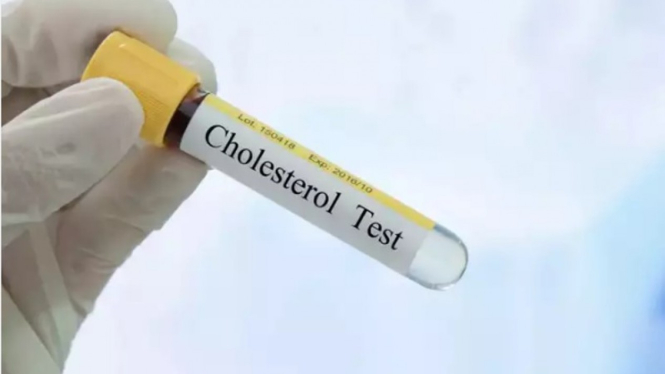 Kolesterol 