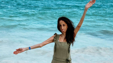 Lizzie Velasquez