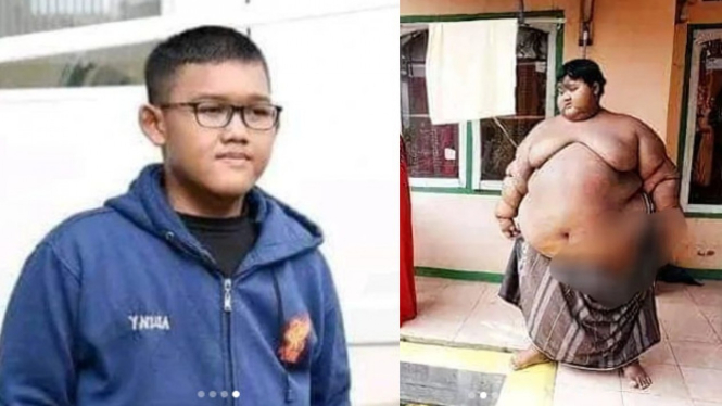 Penampilan Arya Permana anak asal Karawang dulu dan kini