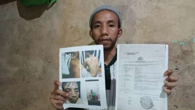 Jamal, karyawan yang dianiaya dan disekap bosnya