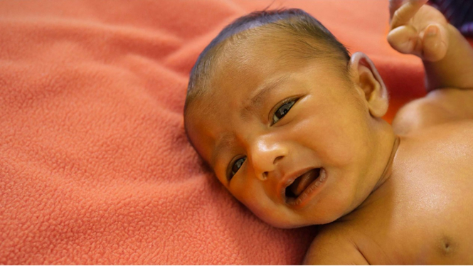 Penyakit kuning pada bayi